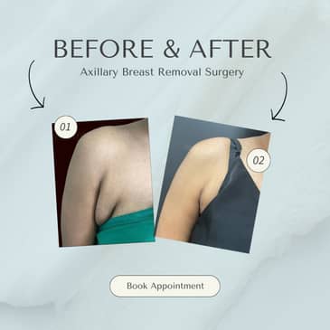 Slider image (5) Konarc Aesthetics - Plastic & Cosmetic Surgery In Gurgaon, India.